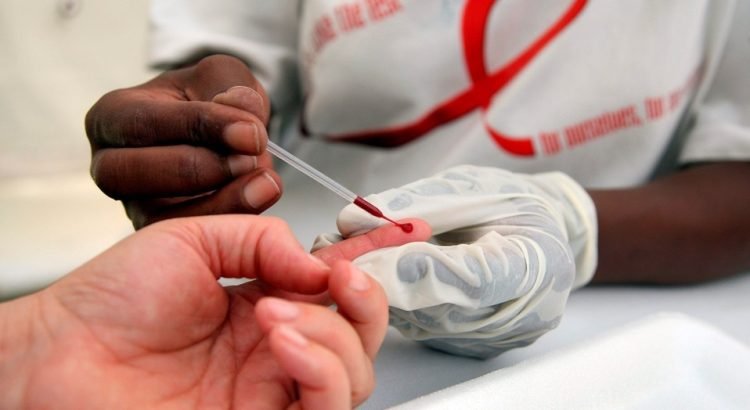 Tuxtepec, tercer lugar de contagios de VIH en Oaxaca, según la Red Oaxaqueña por el VIH